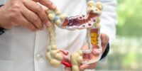 Study Evaluates Impact of Administration of Oral Serum-Derived Bovine Immunoglobulin on Dysbiosis